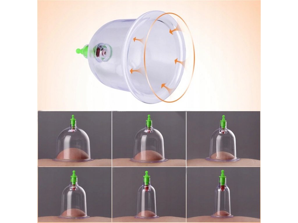 terapijske vakuumske banke